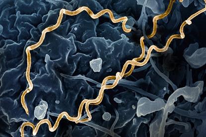 Treponema_pallidum_Bacteria_(Syphilis)