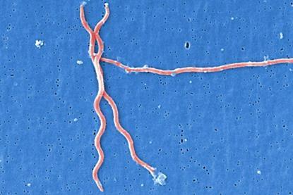 Lyme_disease_parasite_Borrelia_burgdorferi