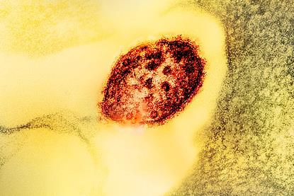 Measles_Virus_Particle