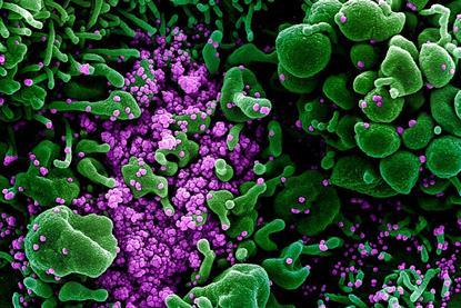 Novel_Coronavirus_SARS-CoV-2_(49666286236)