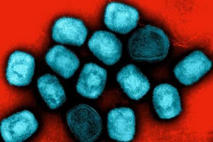Mpox_Virus_Particles