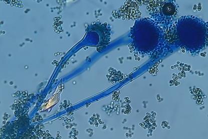 Conidia,_sterigma,_vesicle,_and_conidiophore_of_Aspergillus