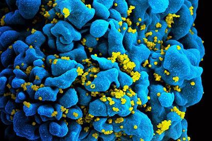 HIV-infected_T_cell_(6813384933)