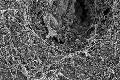 Blokesch lab SEM2