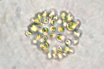 Microcystis_aeruginosa