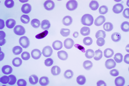 Plasmodium_falciparum_01