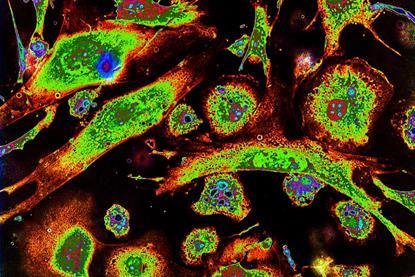 Epithelioid_cells_and_macrophages_in_cell_culture