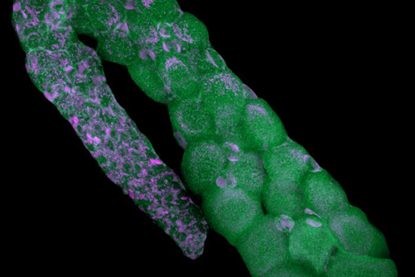 Low-Res_Ostracod ovarium with endosymbiotic bacteria (Cardinium) in magenta Credit Schon and Chimileski, Proc. Royal Soc. B (2025)