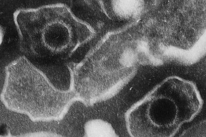 Epstein_Barr_Virus_virions_EM_10.1371_journal.pbio.0030430.g001-L