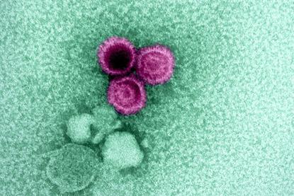 Electron_micrograph_showing_three_Epstein-Barr_virus_(EBV)_particles_colorized_pink