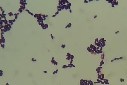 Enterococcus_faecium_in_Gram_Staining_of_culture