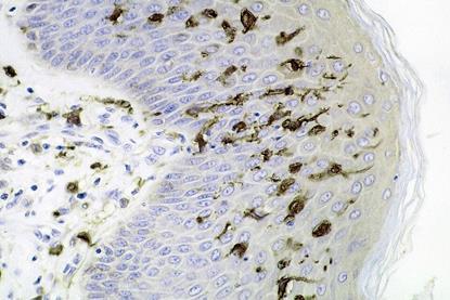 Dendritic_cells