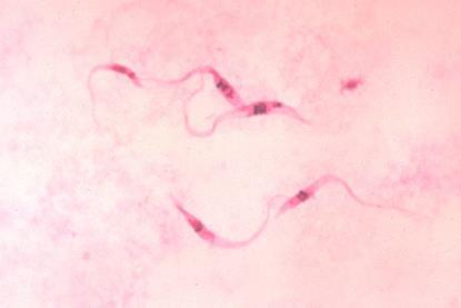 Trypanosoma_cruzi_crithidia