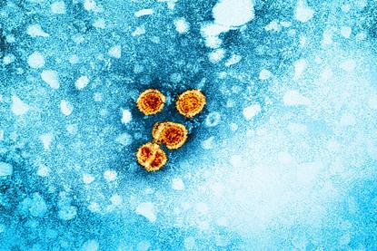 Hepatitis_B_Virus_(52443792486)