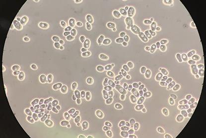 Saccharomyces_cerevisiae_100x_phase-contrast_microscopy2 (1)