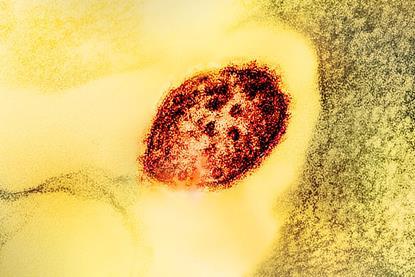 Measles_Virus_Particle (1)