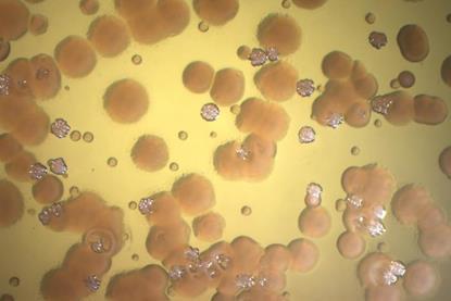 Low-Res_Pradeep Singh Micrograph 3