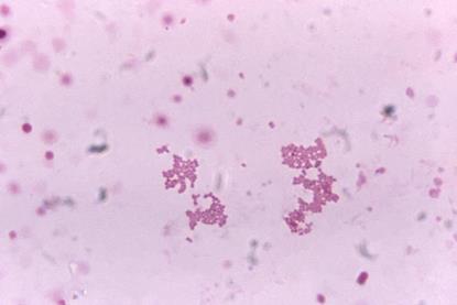 Veillonella_spp._under_1125X_magnification