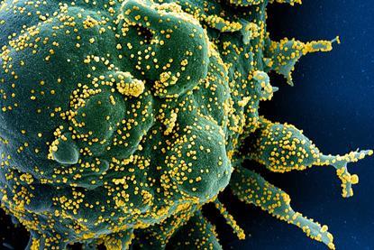 SARS-COV-2_virus (1)