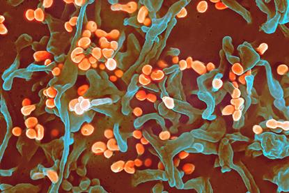 Lassa_virus_budding_off_a_Vero_cell