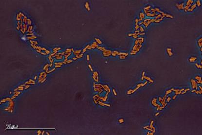 Escherichia_coli_(259_03)_Gramnegative_rods