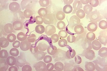 T._cruzi_trypomastigotes_in_peripheral_blood_smear