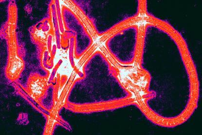 Ebola_virus_particles