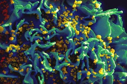 HIV-infected_H9_T_cell_(6813403685)