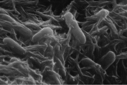 Shewanella_oneidensis