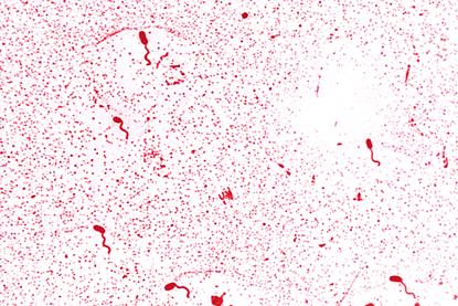 Vibrio_cholerae_01 (1)