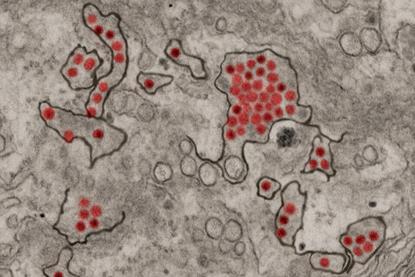 Zika_Virus_Particles_(23686785478)