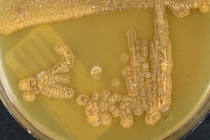Amycolatopsis_orientalis_subsp._orientalis_(Pittenger_and_Brigham_1956)_Lechevalier_et_al._1986