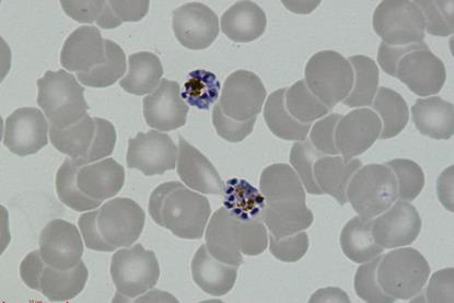 P._vivax_-_schizonts