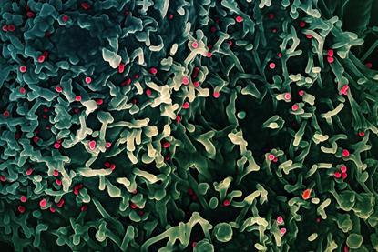 Mpox_Virus_(52704526002)