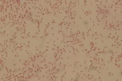 Gram_Negative_Rods_of_Aeromonas_hydrophila