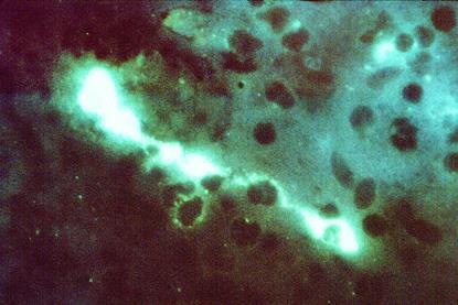 Chlamydophila_psittaci_FA_stain