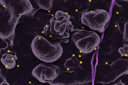 Crimean-Congo_Hemorrhagic_Fever_(CCHF)_Virus_(41541604722)