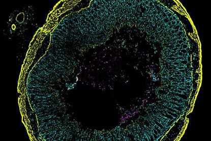 Low-Res_260305_Cdiffflourescentimage