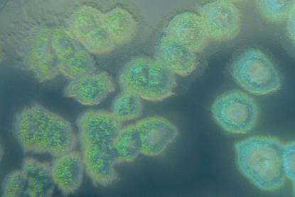 Pseudomonas_aeruginosa_on_cetrimide_agar (1)