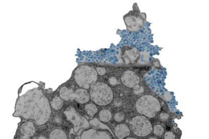 Low-Res_Human nasal epithelial cell releasing rhinovirus (blue) CREDIT Julien Amat & Bao Wang