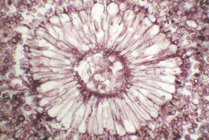 Aspergillus_-_Conidial_head_(5414785274)