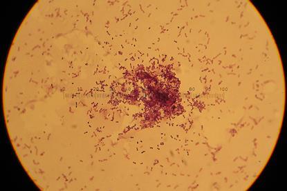 Lactococcus_lactis