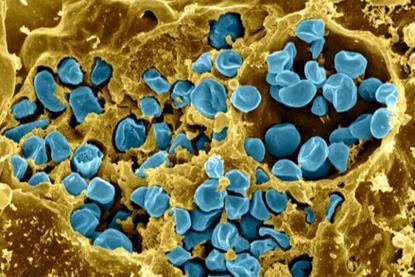 Macrophage_Infected_with_Francisella_tularensis_Bacteria_(5950310835)