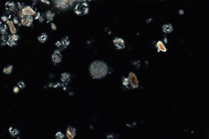 Low-Res_Pic2_nannofossils