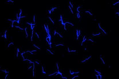 Low-Res_Borrelia_recurrentis_c_Flavia_Reyer_unimedizin-ffm
