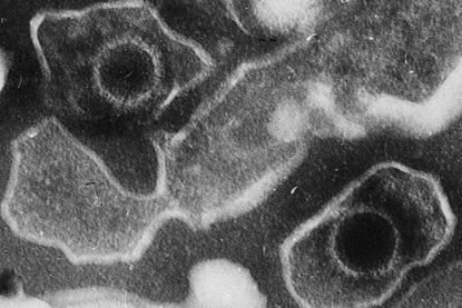 Epstein_Barr_Virus_virions_EM_10.1371_journal.pbio.0030430.g001-L
