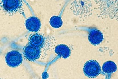 Antonio_e_Biagio_e_Cesare_Arrigo_Aspergillus_fumigatus_01