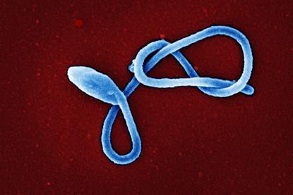 Ebola_Virus_Particle_(52425482029)