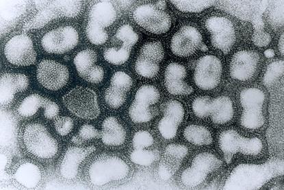 Influenza_A_-_late_passage (1)
