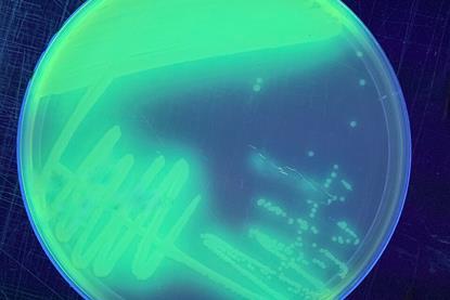Pseudomonas_putida_on_King's_B_agar_under_UV_light